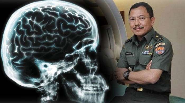  Dokter Terawan Ahli Cuci Otak Dianggap Tidak Terbuka, Izin dicabut